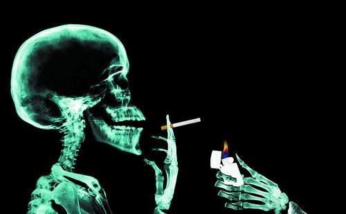 剖析的典型“吸烟病”-血栓闭塞性脉管炎。