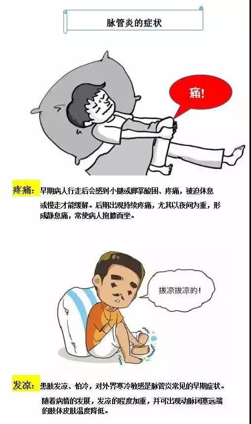 脉管炎危害这么大，你却不知道……